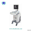 HBW-10 Plus équipement médical à prix compétitif Scanner à ultrasons portable entièrement numérique pour chariot