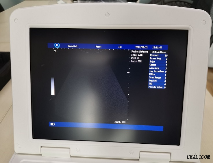 Appareil de diagnostic médical de l'hôpital HBW-4 portable Machine à ultrasons noir et blanc ordinateur de poche entièrement numérique 2d USB scanner à ultrasons