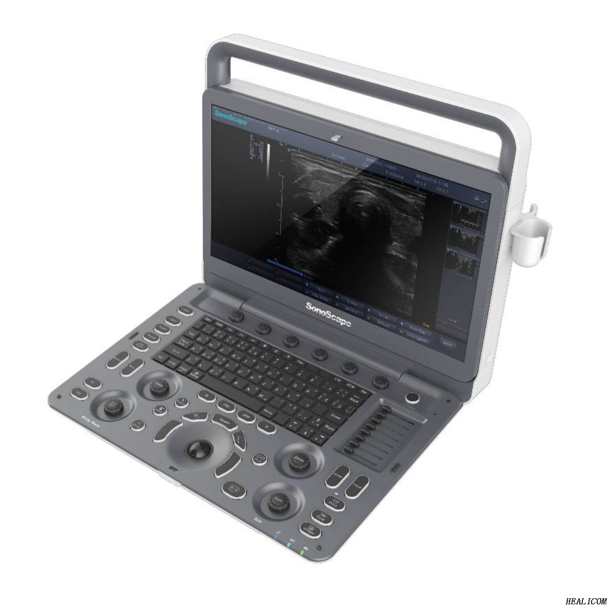 L'hôpital professionnel SonoScape E2 utilise un système de diagnostic complet de la machine à ultrasons Doppler couleur numérique