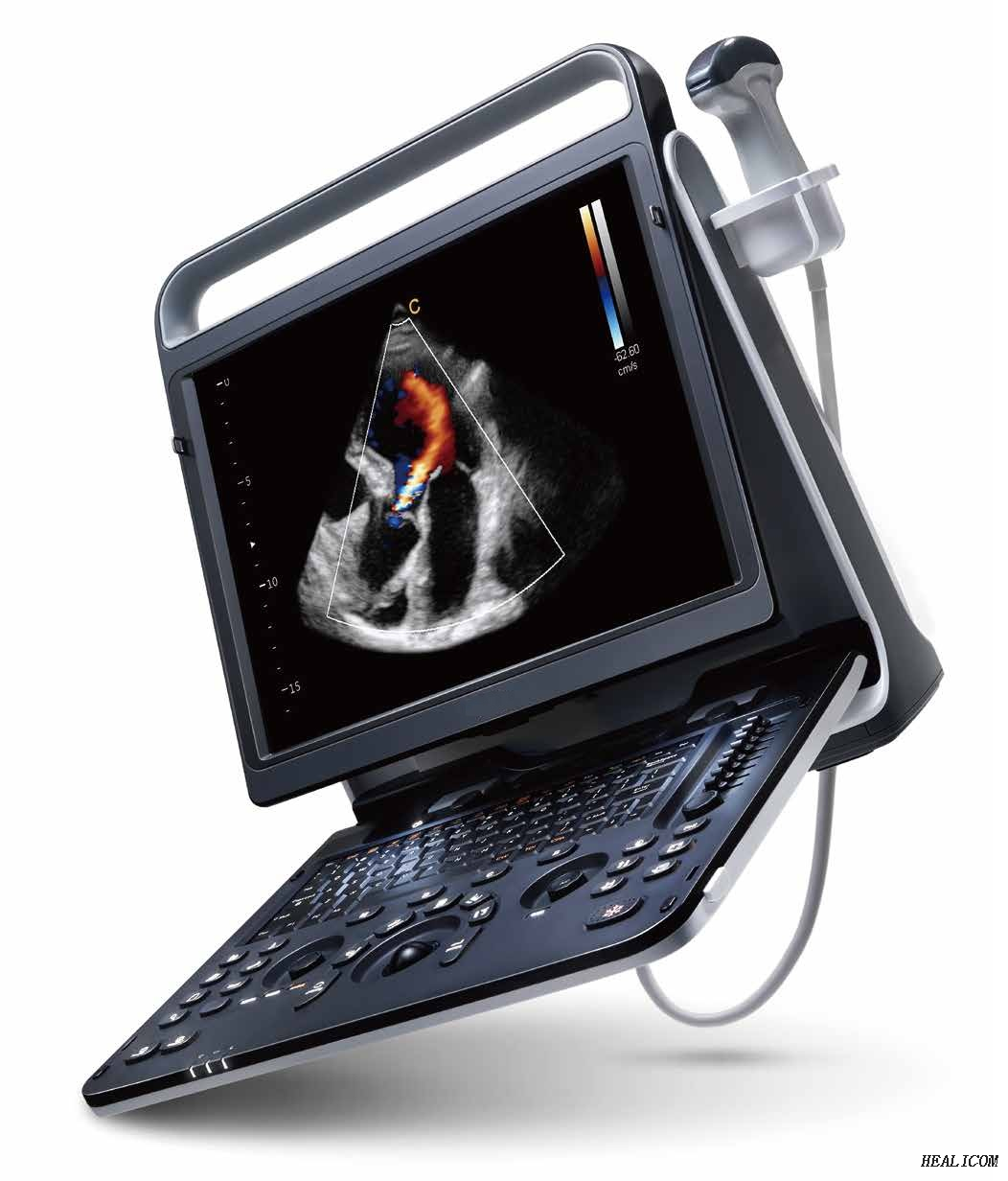 Système de diagnostic HUC-590 Machine à ultrasons numérique portable Doppler couleur 3D 4DSystème de diagnostic HUC-590 Machine à ultrasons numérique portable Doppler couleur 3D 4D